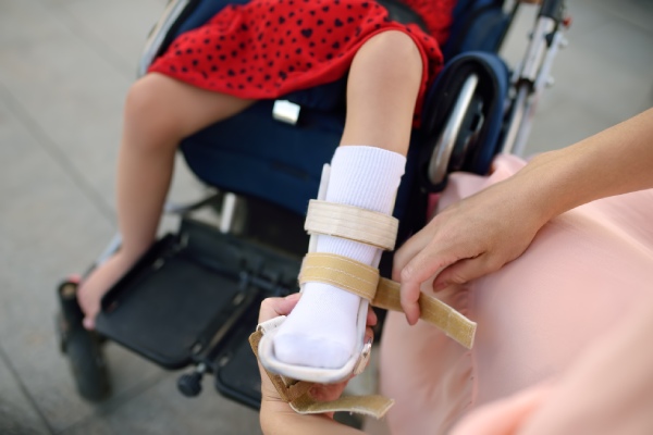 woman making her disabled girl wear orthosis 